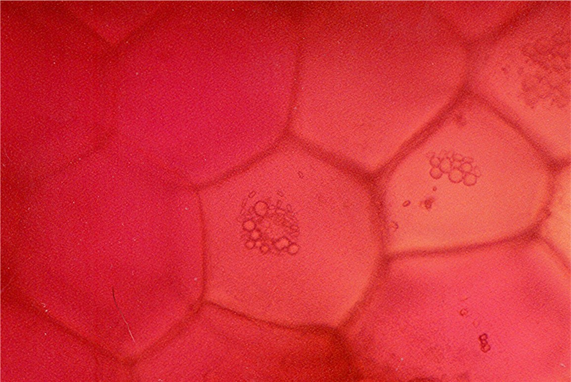 Клетка мякоти рябины. Клетки томата под микроскопом. Клетки мякоти томата под микроскопом. Клетки кожицы помидора под микроскопом. Клетки мякоти томата под лупой.